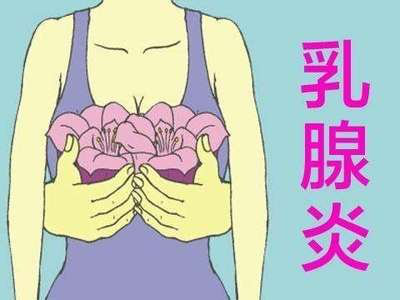 乳腺炎的預防